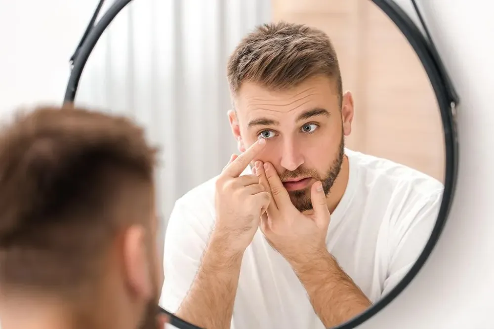 mise en place des lentilles de contact